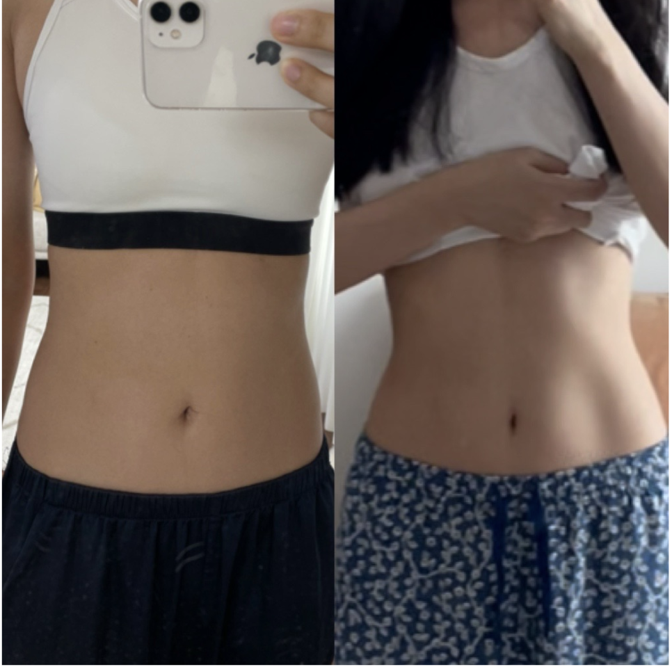 리커버미 체형교정 대표 이미지