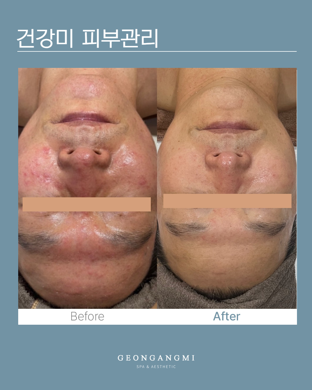 건강미스파 청담점 photo 10