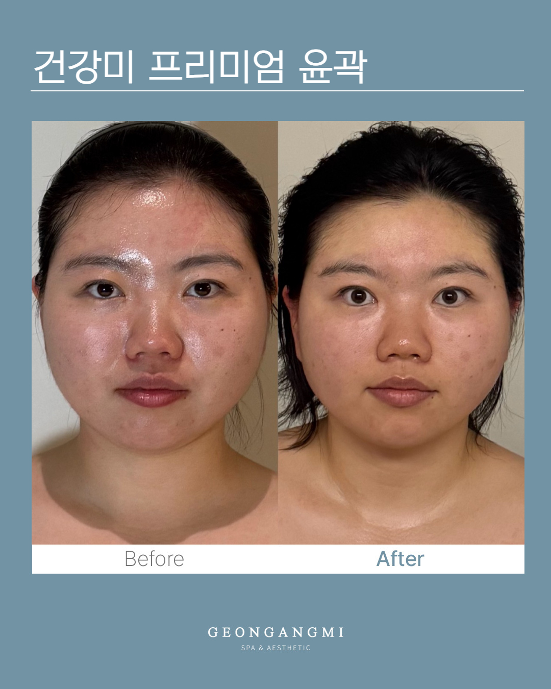건강미스파 청담점 photo 8