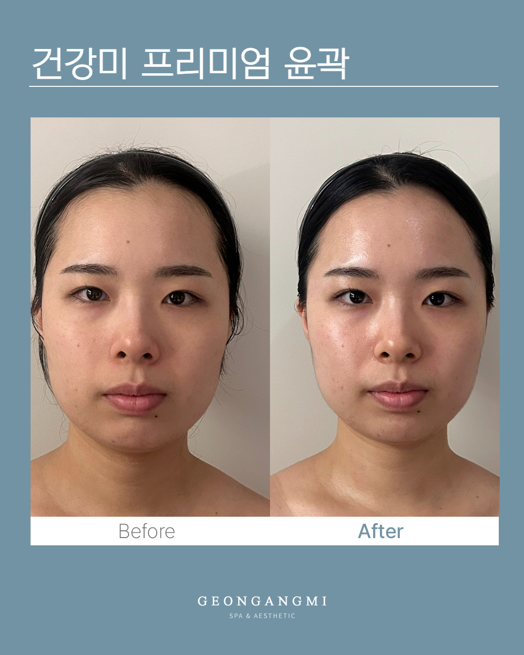 건강미스파 청담점 photo 6