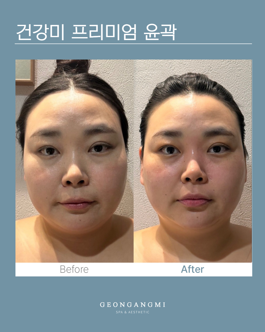 건강미스파 청담점 photo 7
