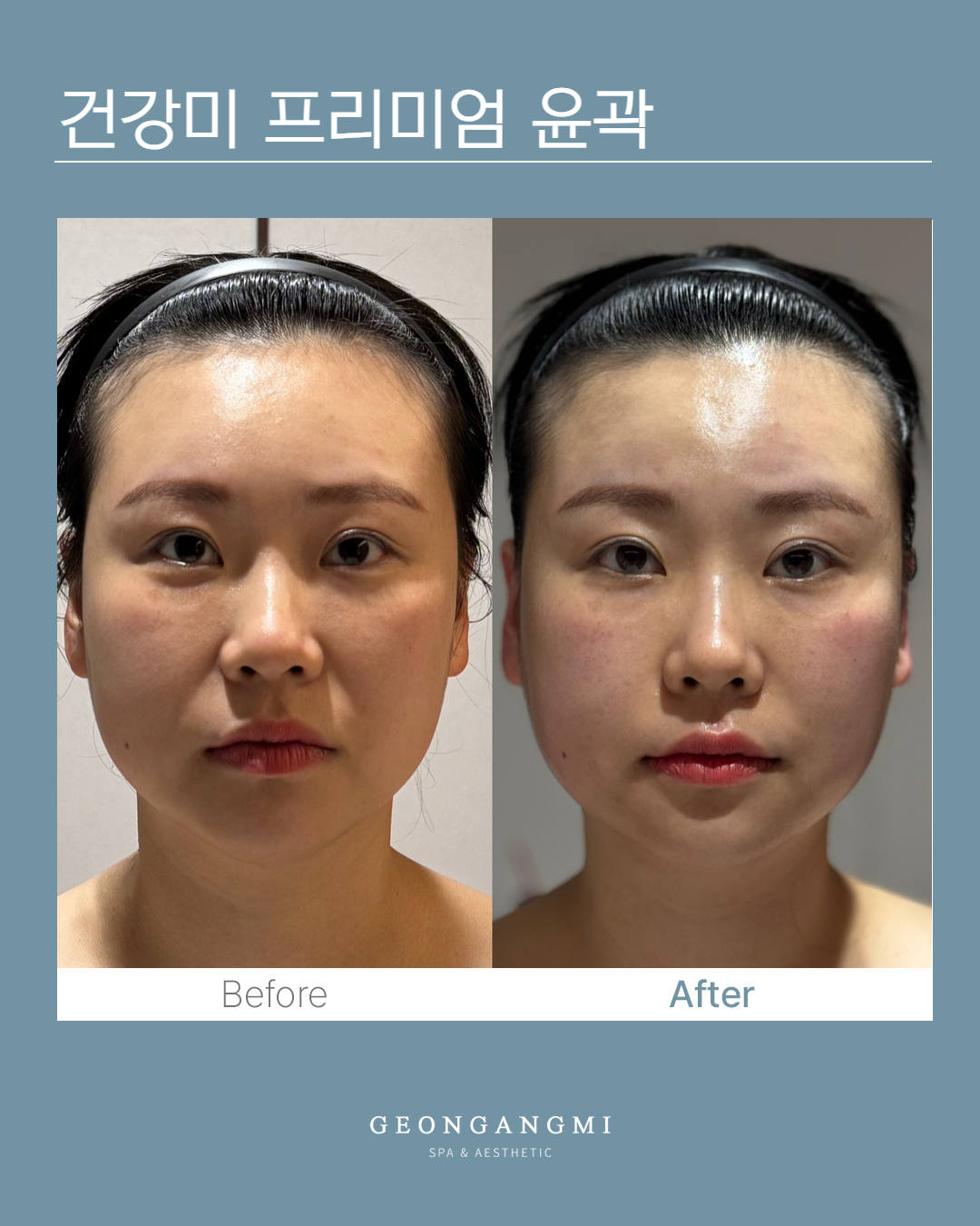 건강미스파 청담점 photo 4
