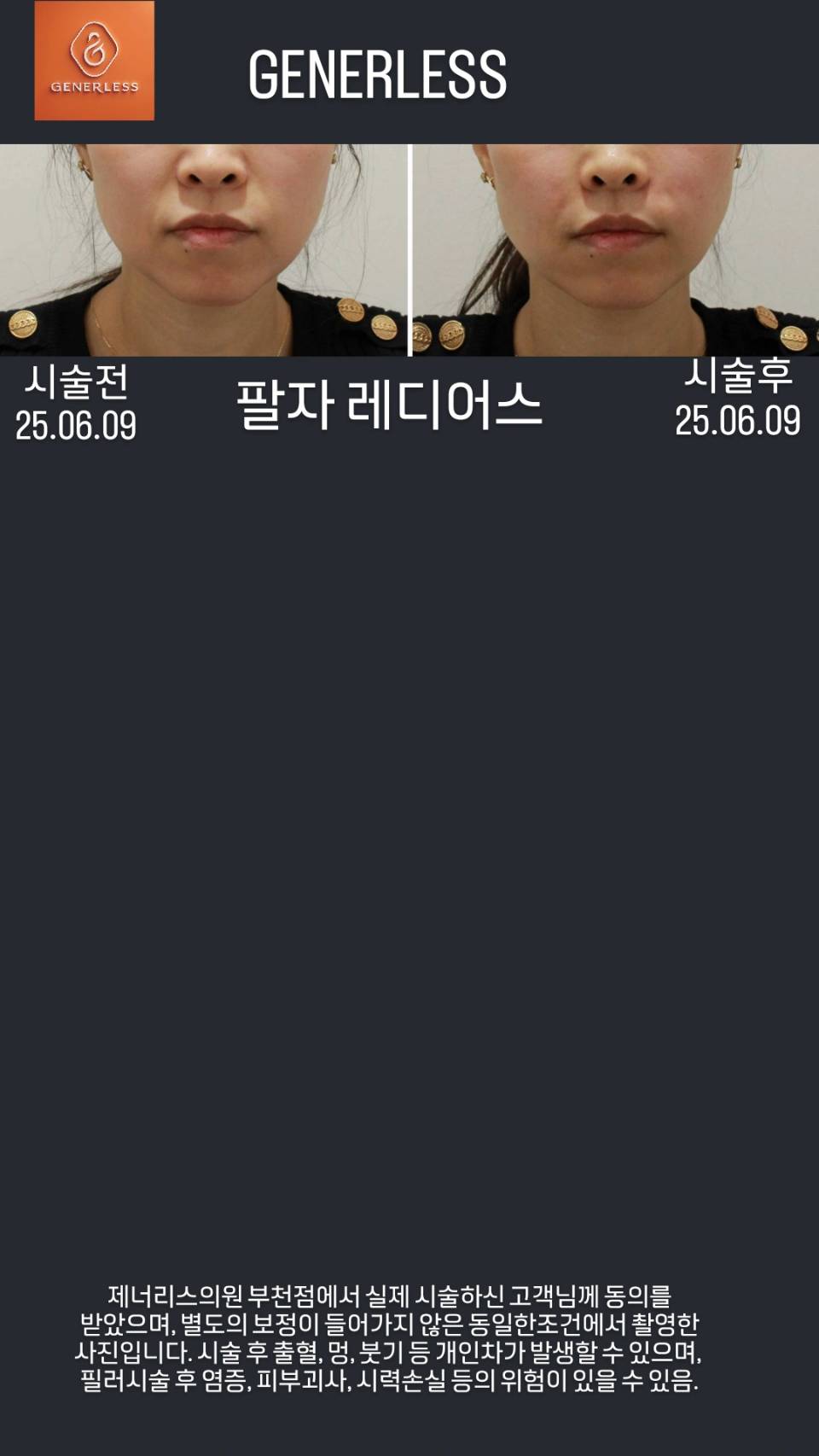 제너리스의원 부천점 대표 이미지