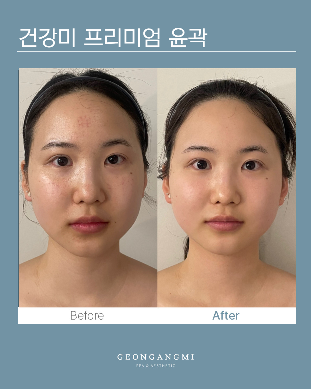 건강미스파 청담점 photo 2