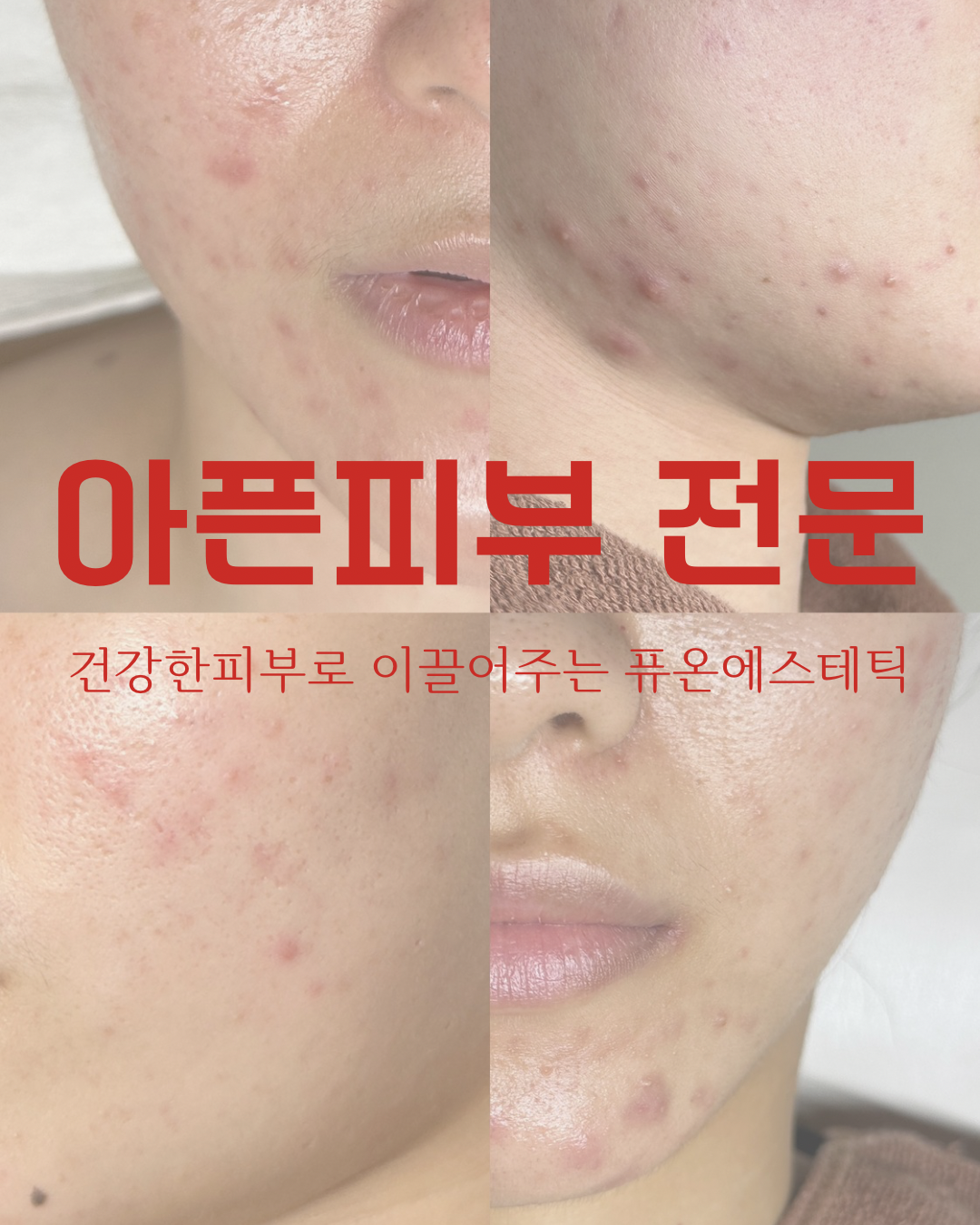 퓨온에스테틱