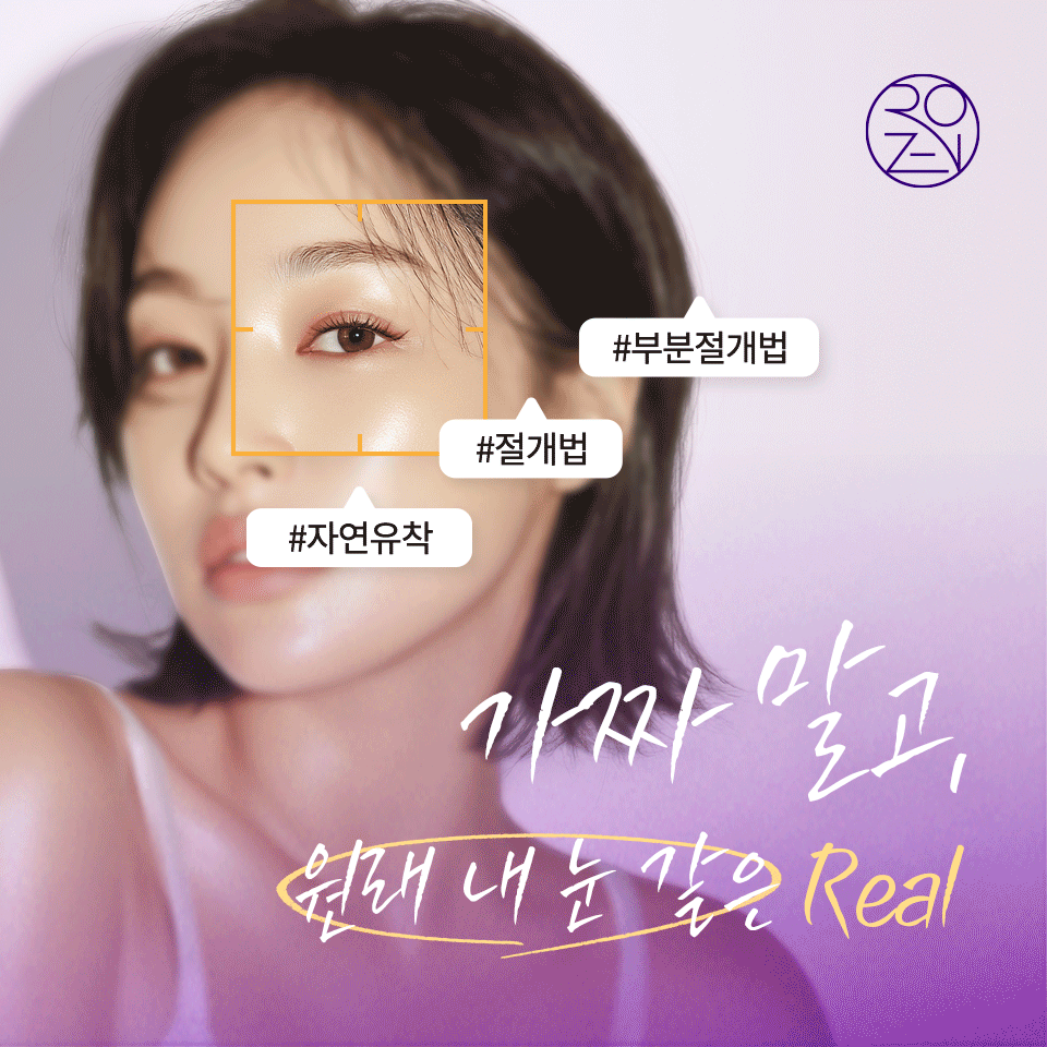 로젠성형외과 대표 이미지