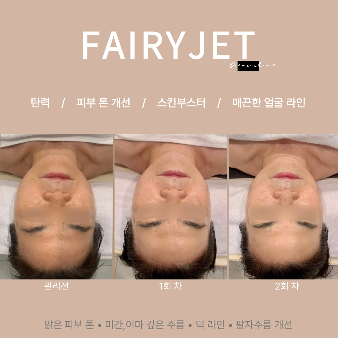 도래피부