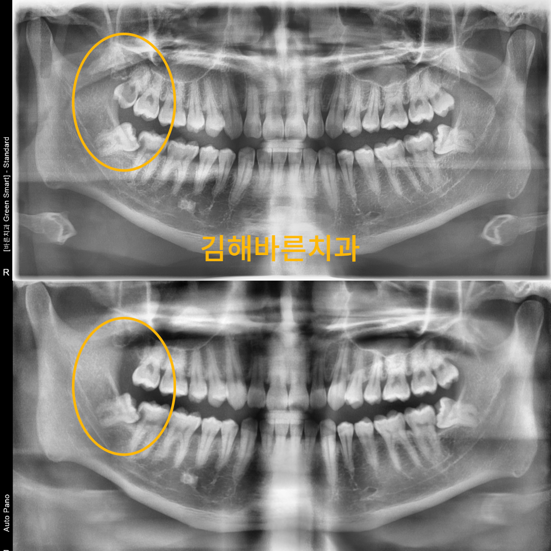 김해바른치과의원 대표 이미지