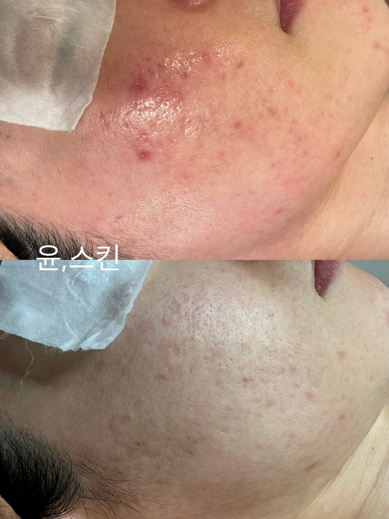윤스킨 대표 이미지