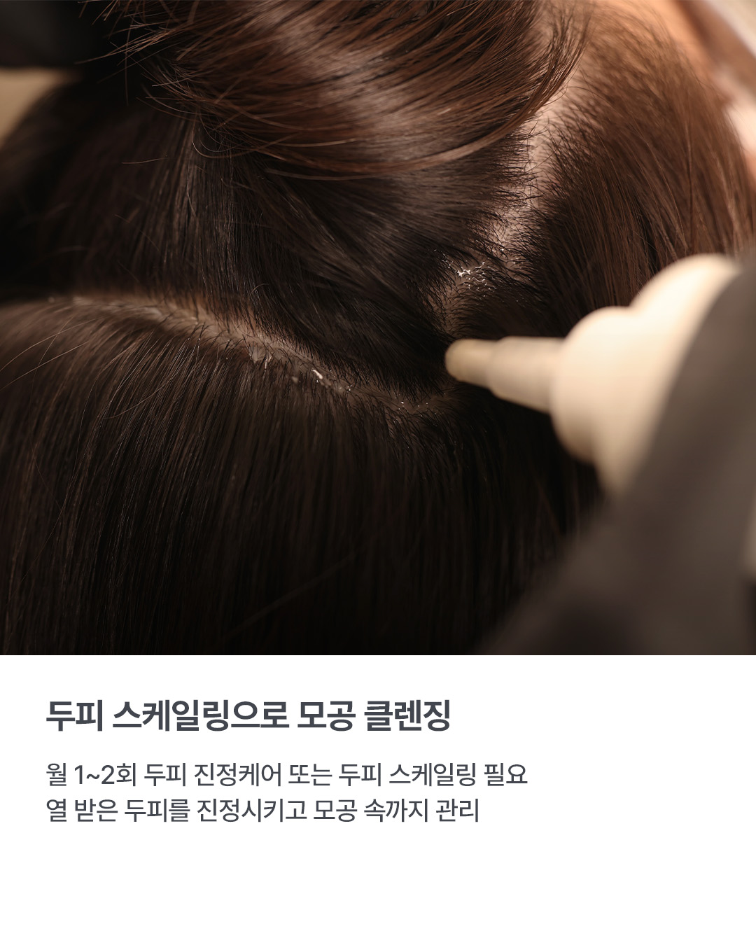 웰킨 두피탈모센터 종로점
