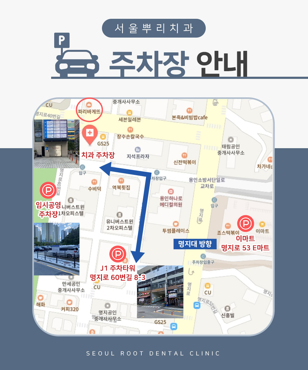 서울뿌리치과 주차장 안내 이미지