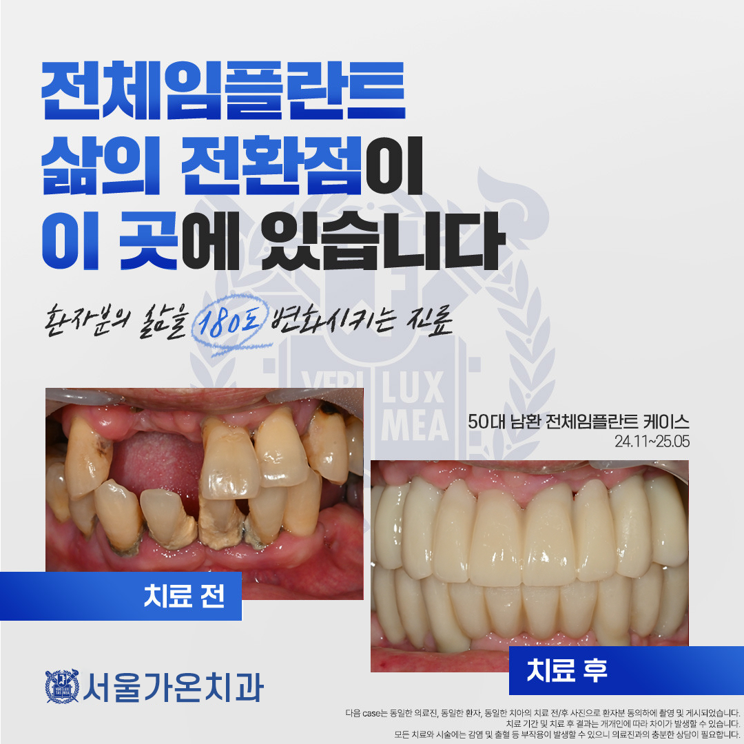 서울가온치과의원 의정부 대표 이미지