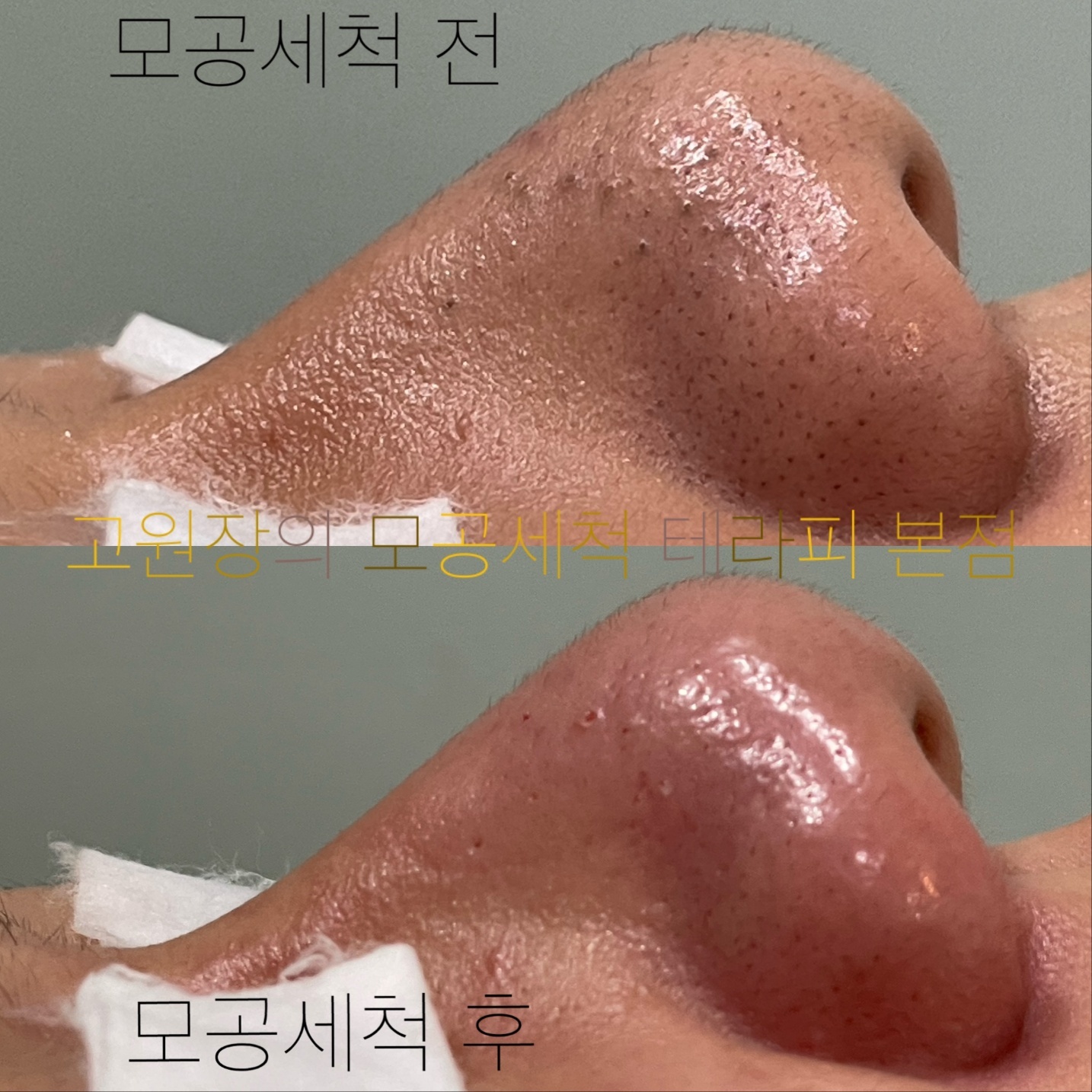 고원장의 모공세척 테라피 경기광주 본점 대표 이미지