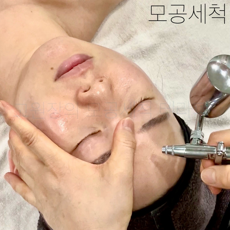 고원장의모공세척테라피 대표 이미지