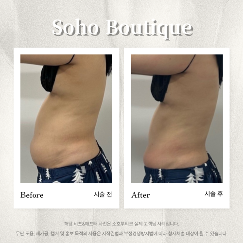 소호부티끄 photo 8