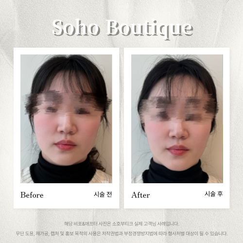 소호부티끄 photo 10