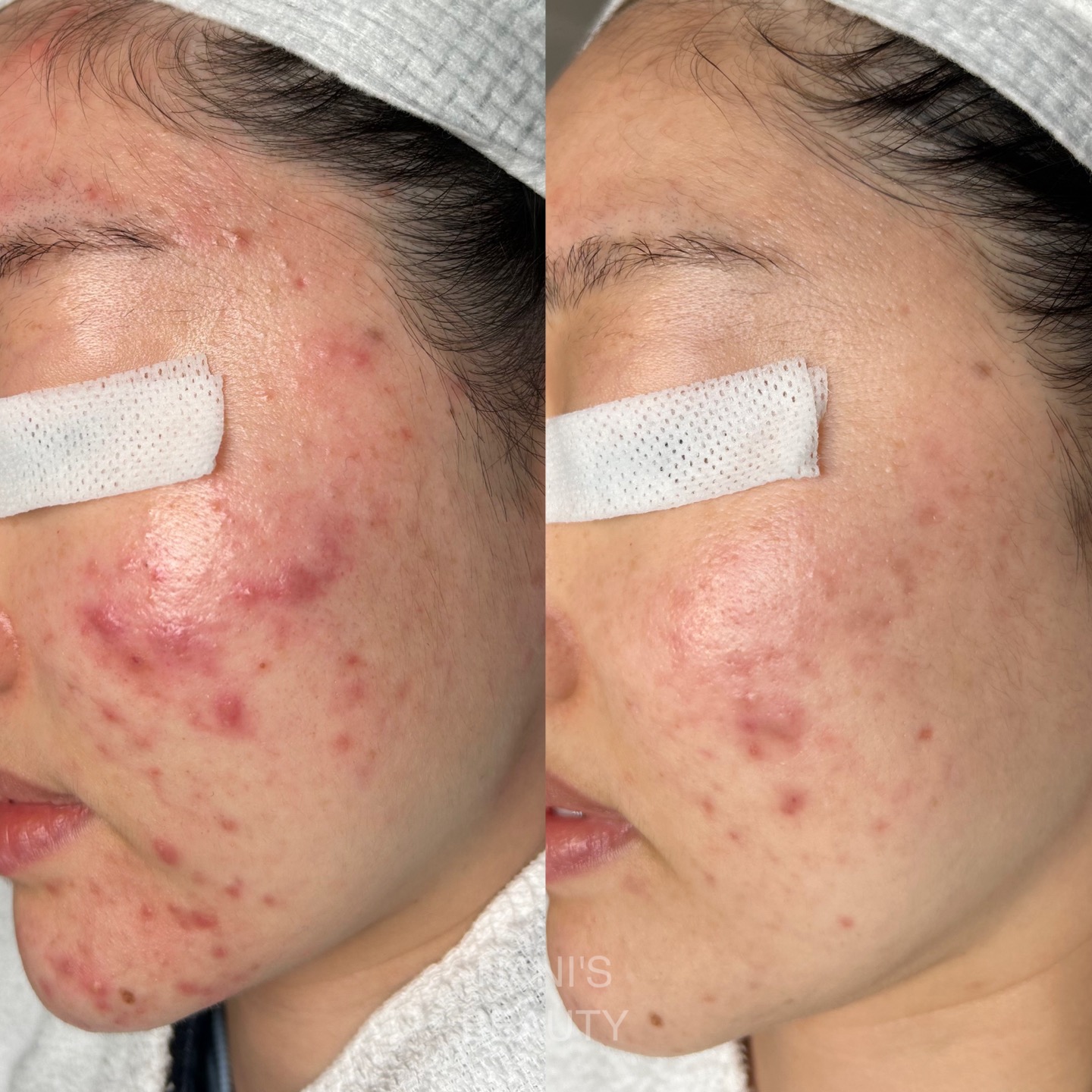 나니스뷰티 대표 이미지