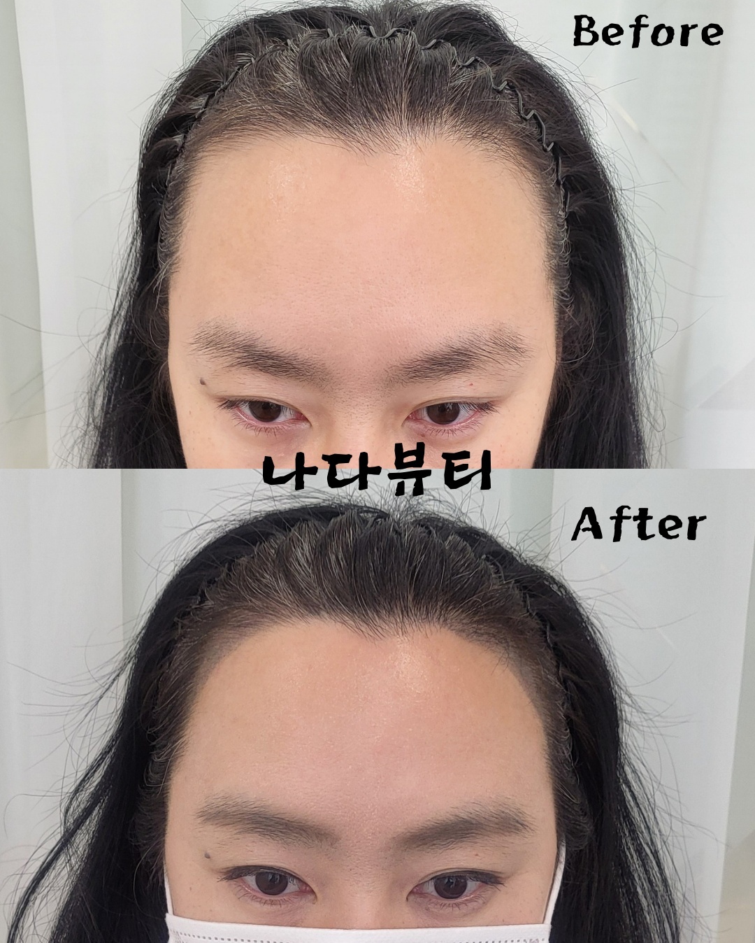 나다뷰티 헤어라인&정수리커버 대표 이미지