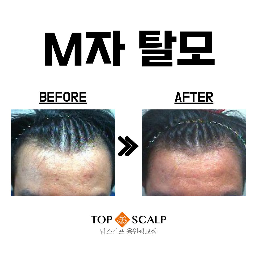 탑스칼프 용인광교점 대표 이미지