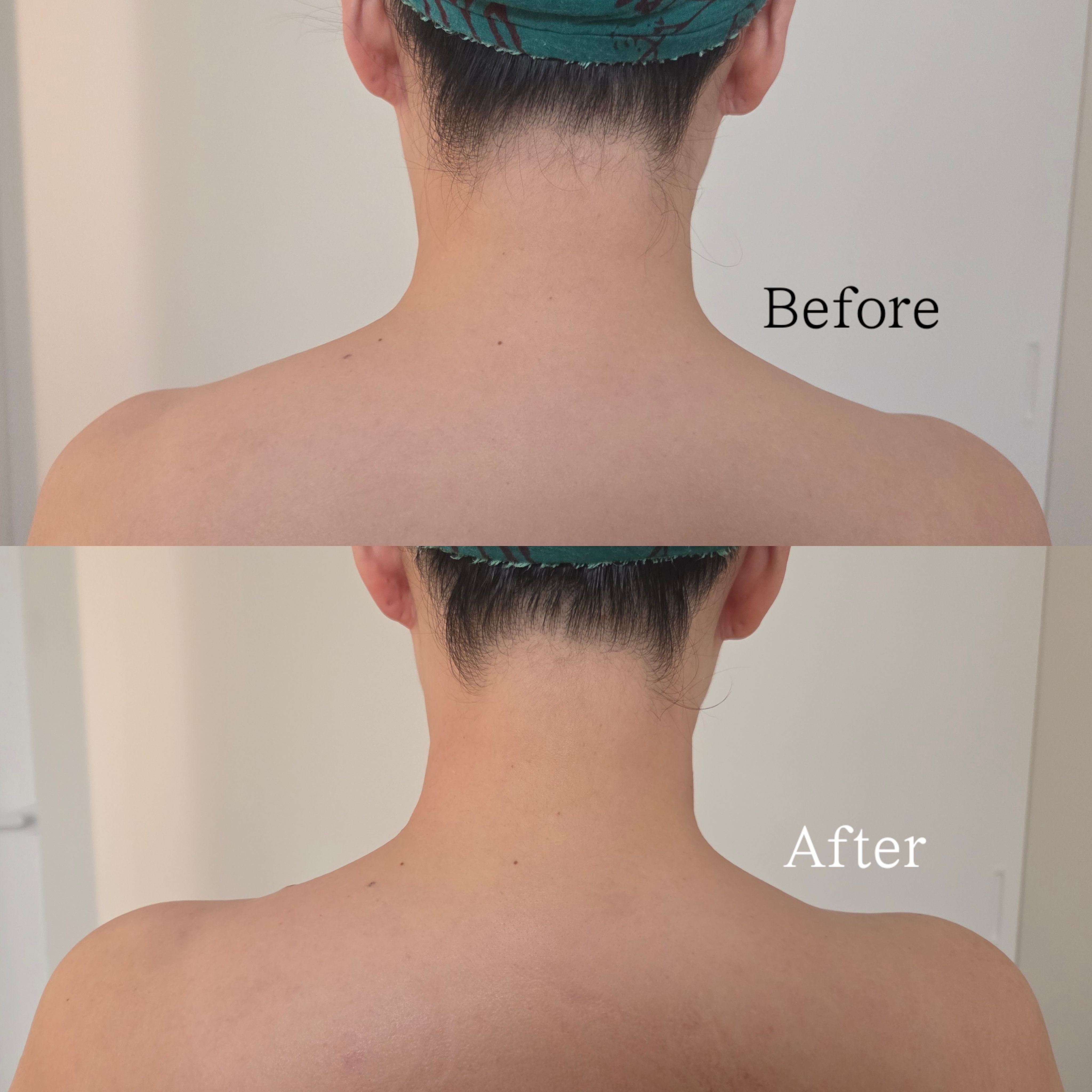 라온에스테틱 원주점 대표 이미지