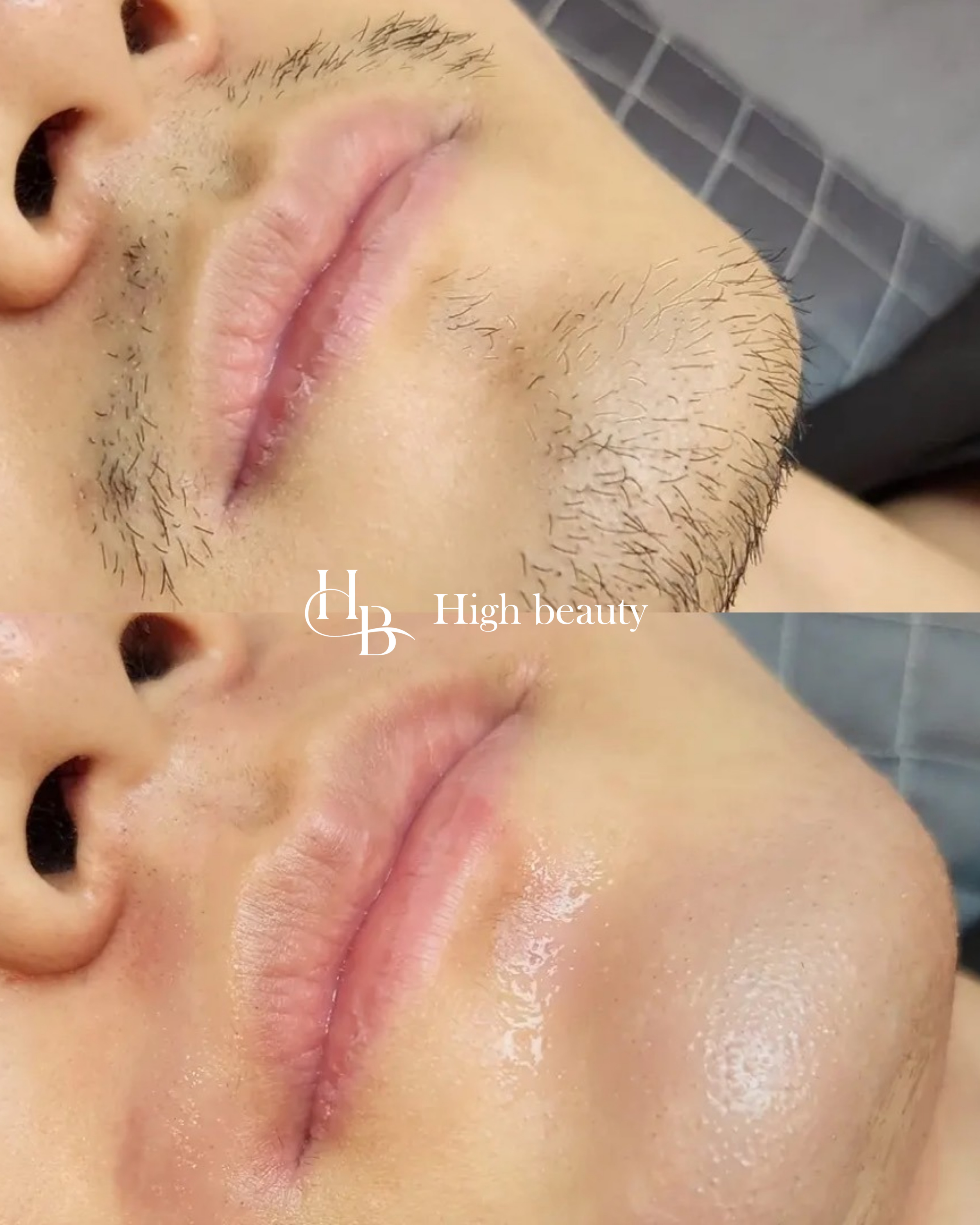 하이뷰티 대표 이미지