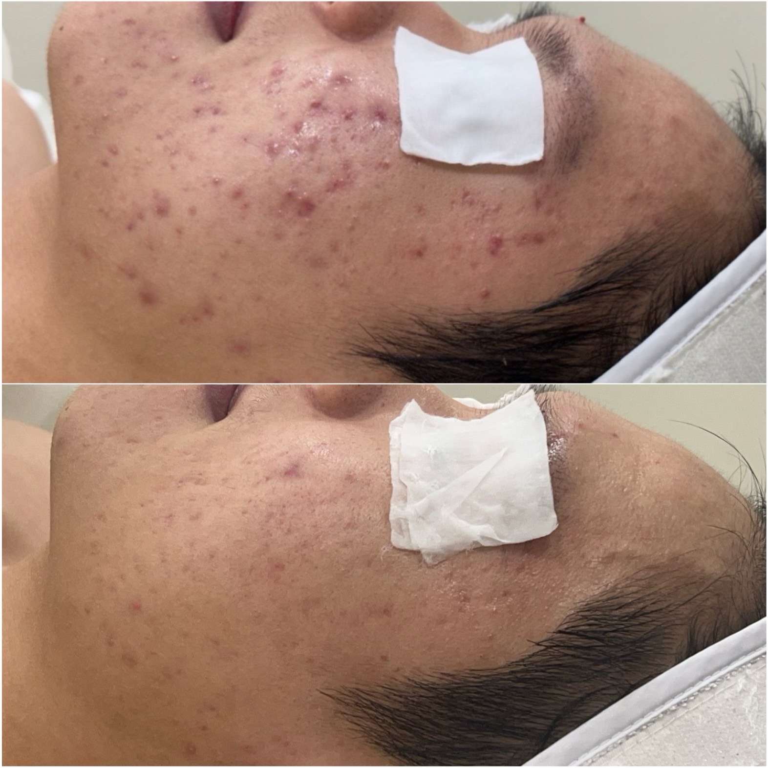 하이필스킨 강남선릉점 대표 이미지