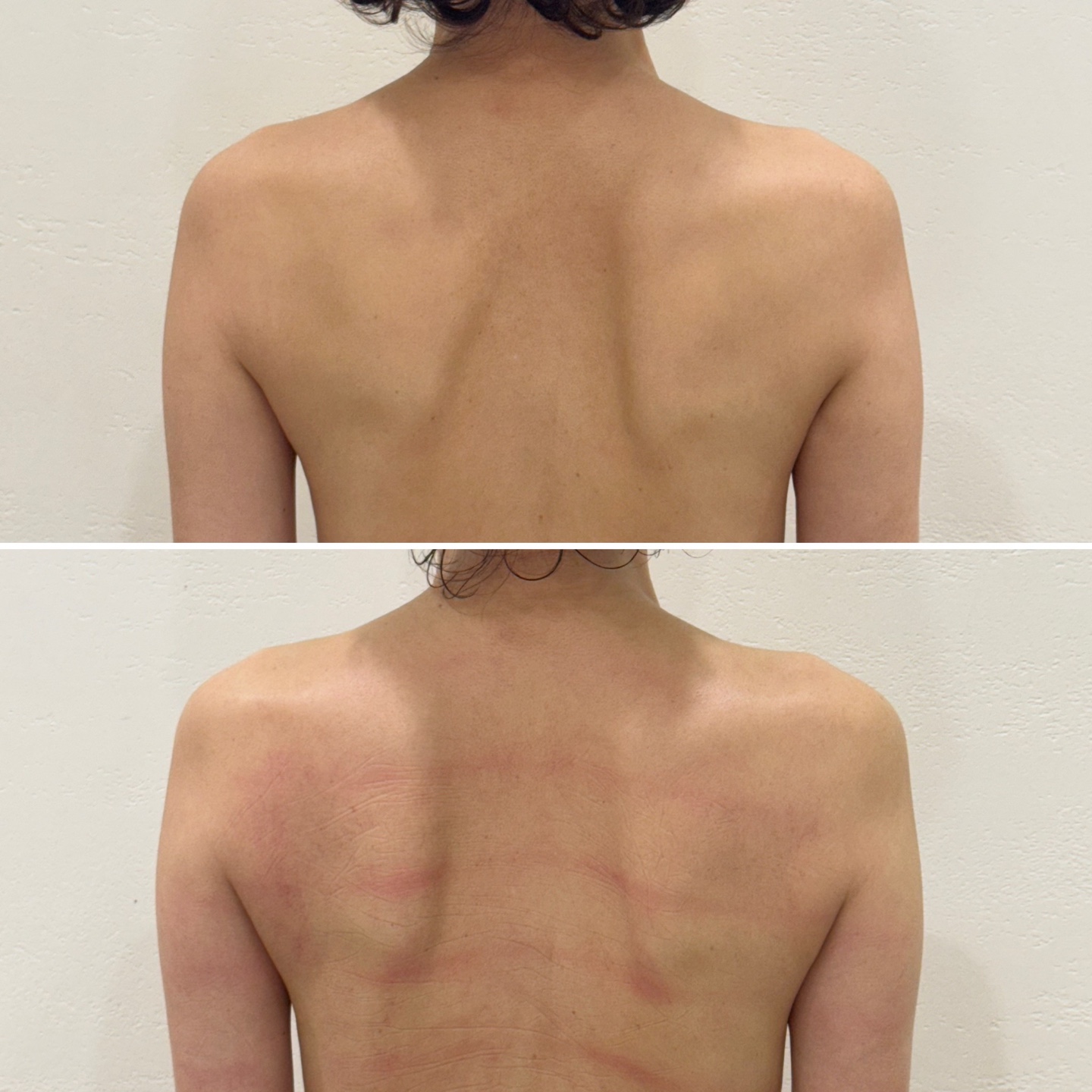 하이필스킨 강남선릉점 대표 이미지