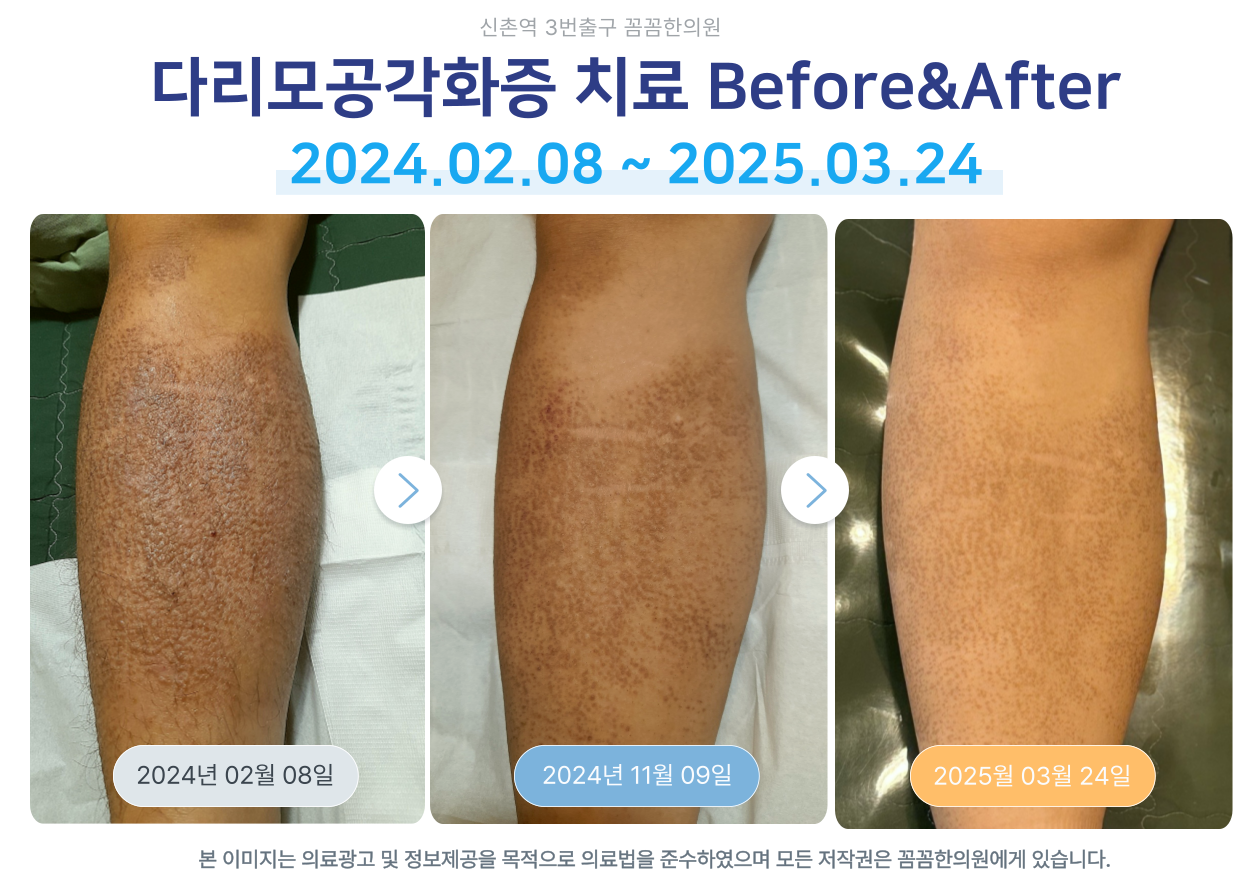 꼼꼼한의원 신촌 대표 이미지