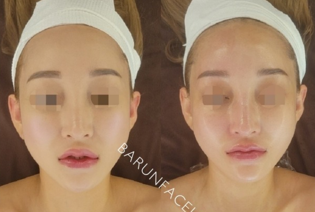 바른얼굴윤곽연구소 대표 이미지