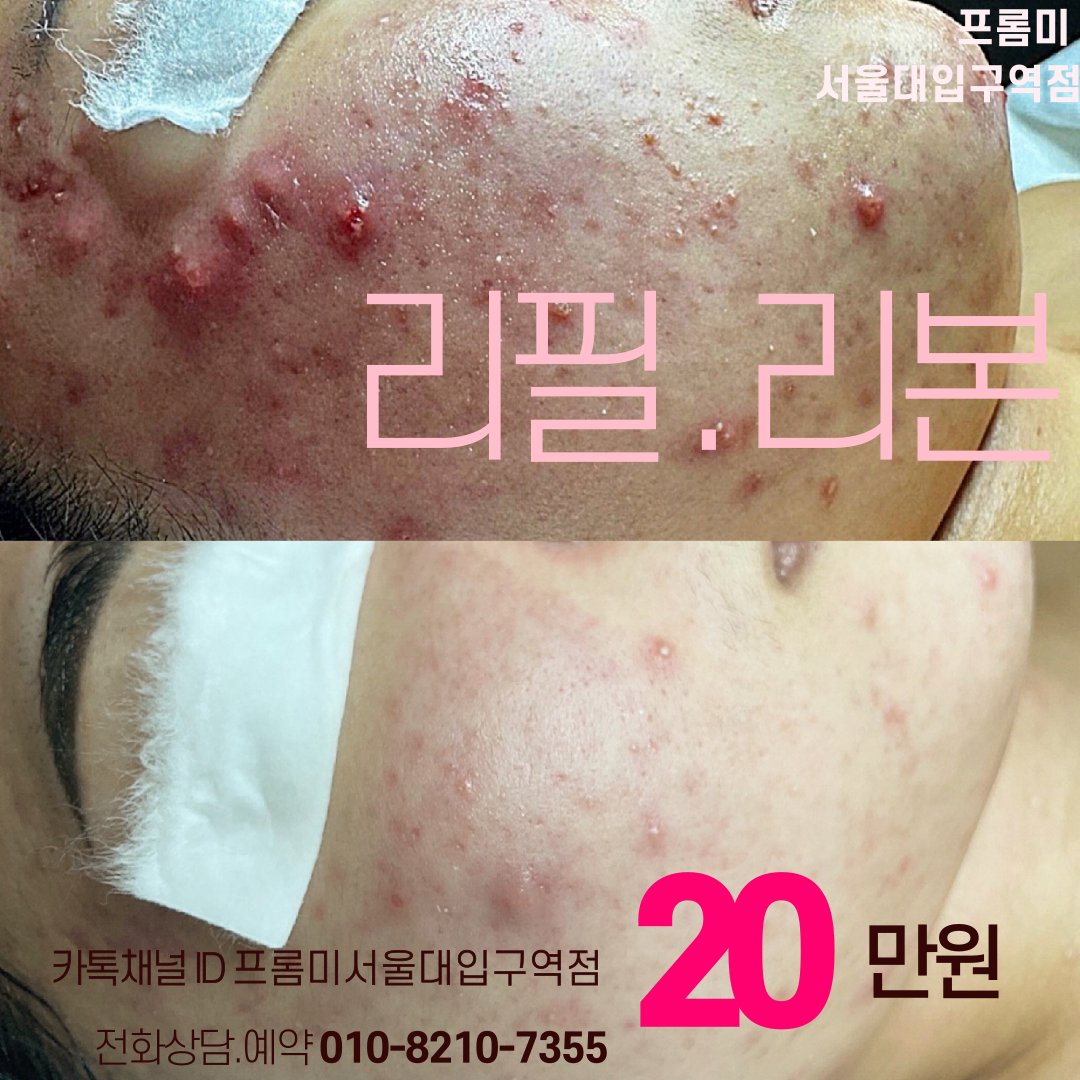 프롬미 서울대입구역점 대표 이미지