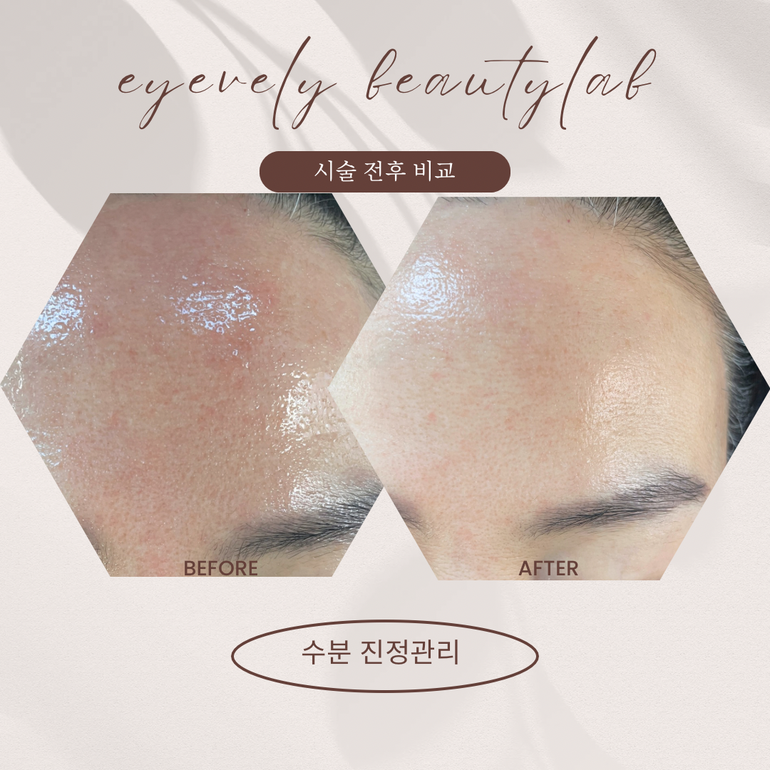 아이블리 뷰티랩 대표 이미지