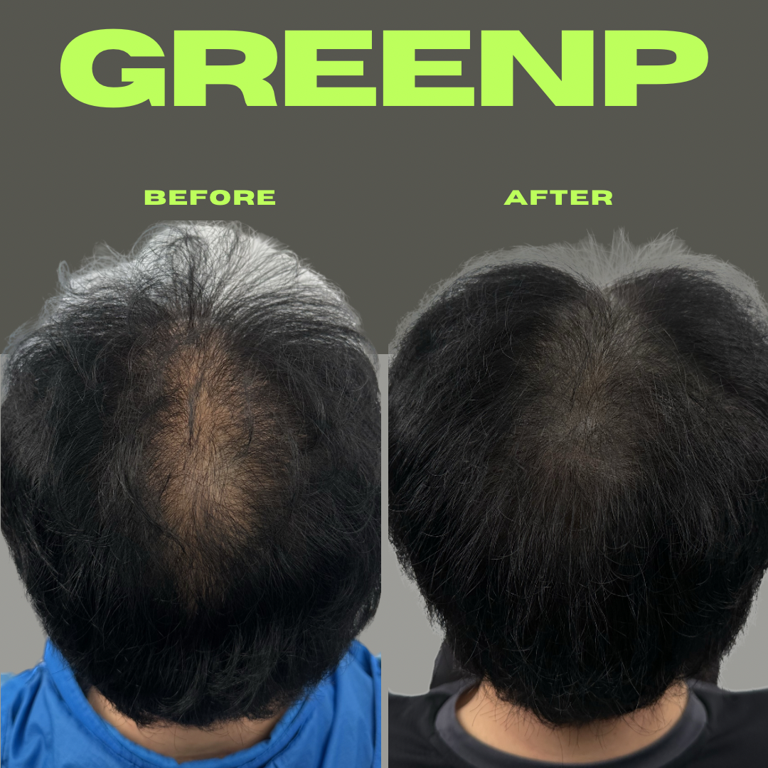 그린피 제주 대표 이미지