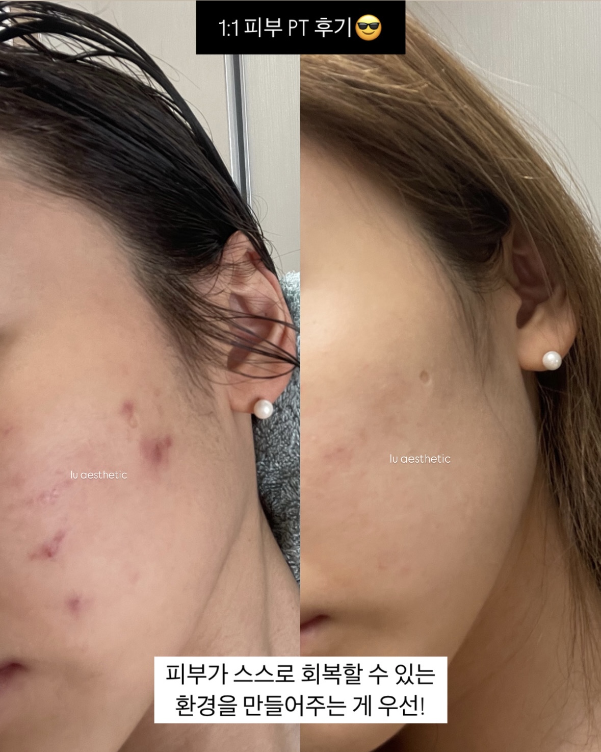 루에스테틱 대표 이미지