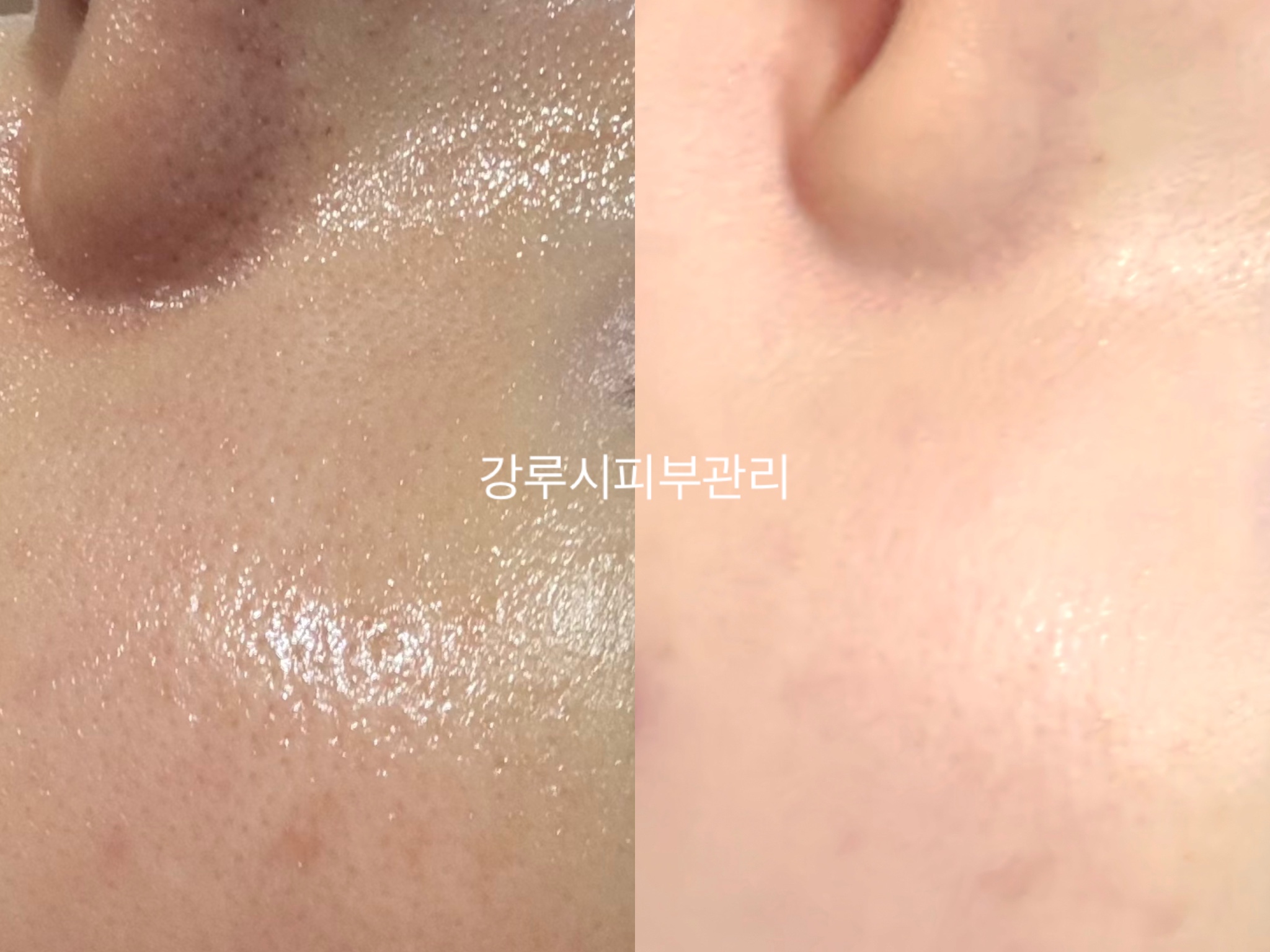 강루시피부관리 대표 이미지