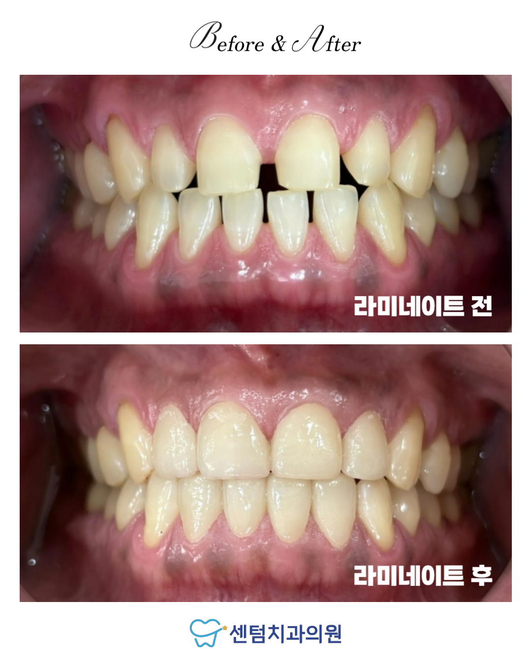 센텀치과의원 광주 대표 이미지