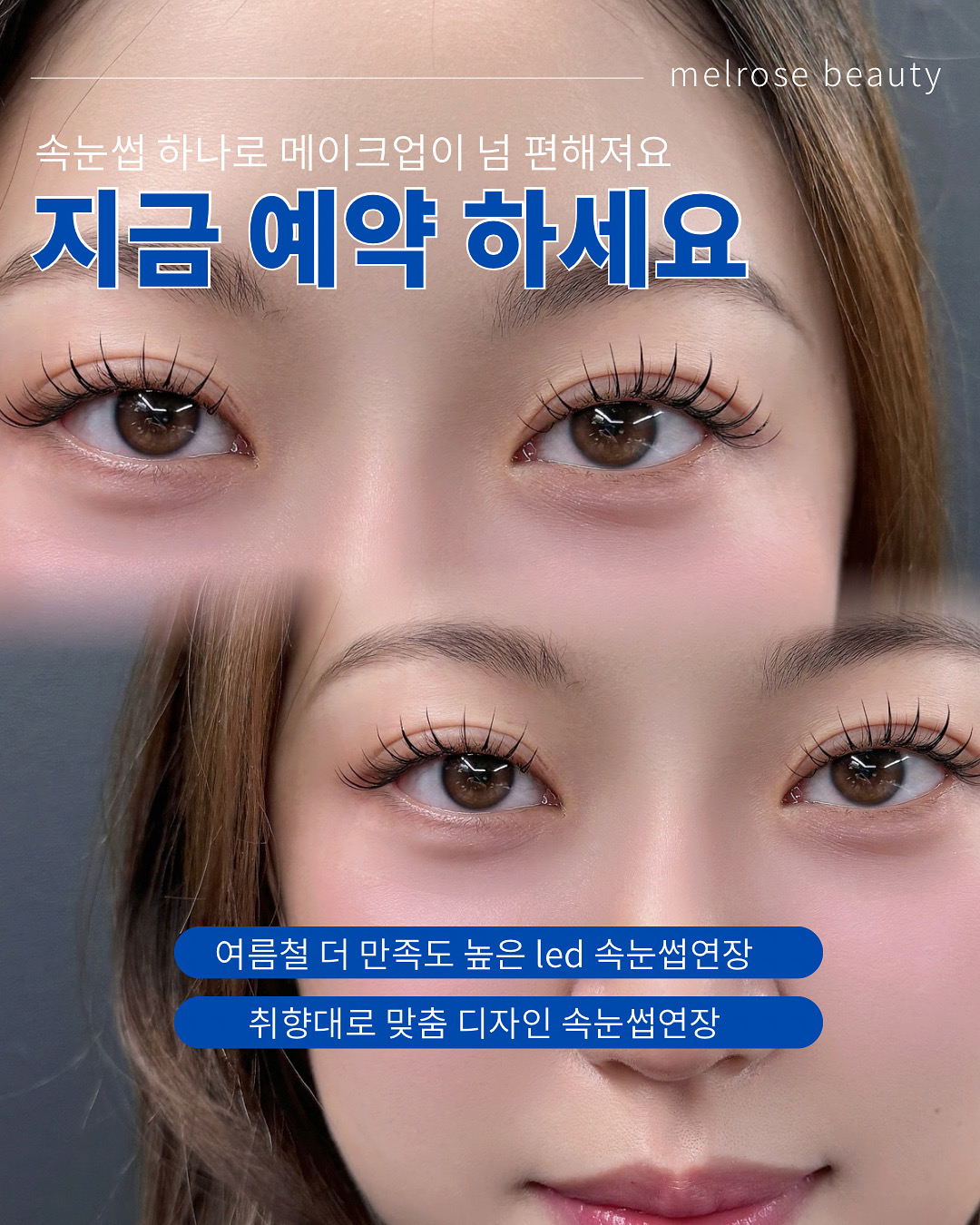 멜로즈뷰티 은평점 대표 이미지