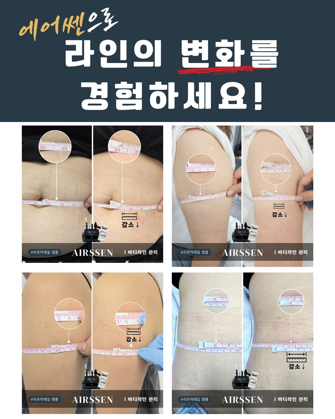 리턴스킨 대표 이미지