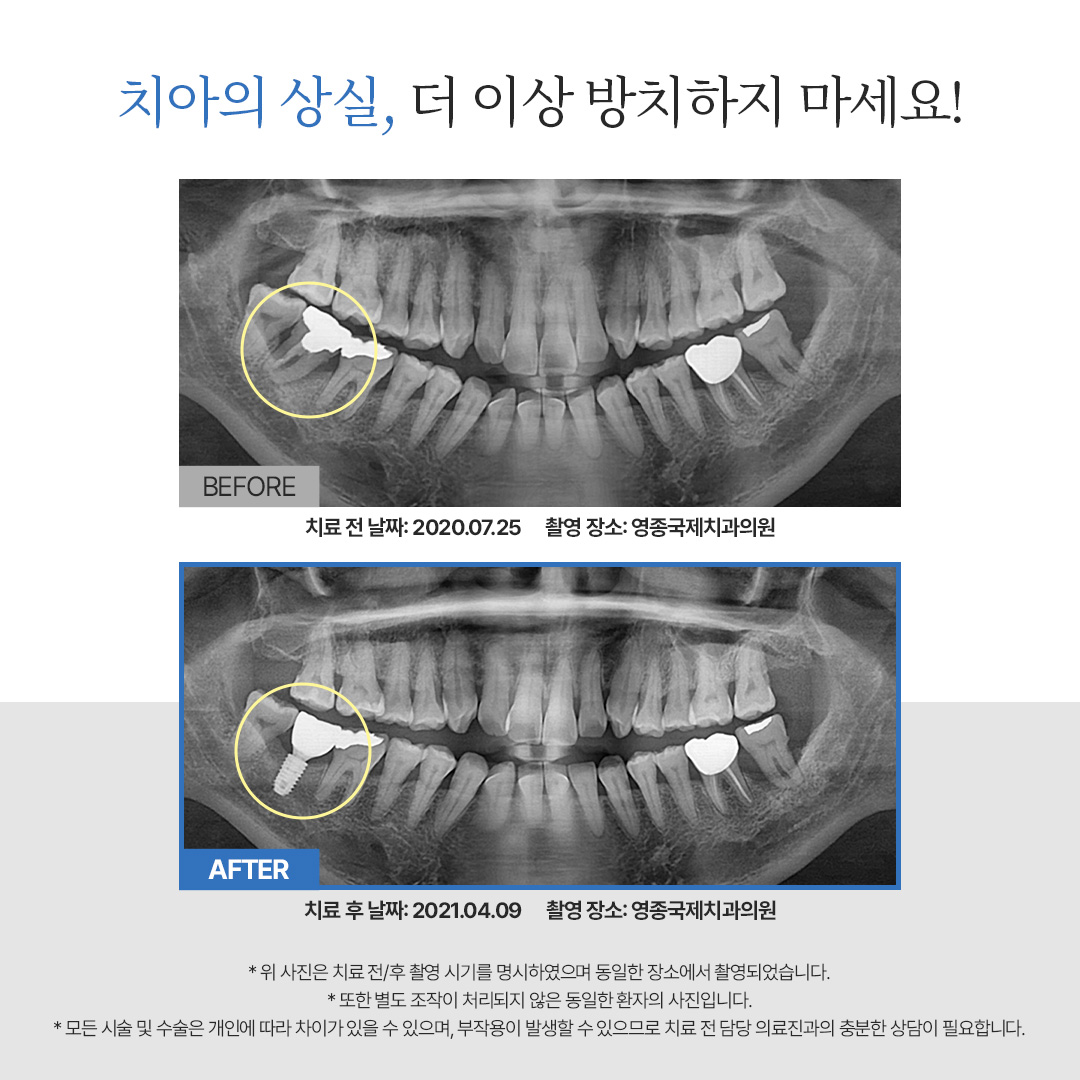 영종국제치과의원 대표 이미지