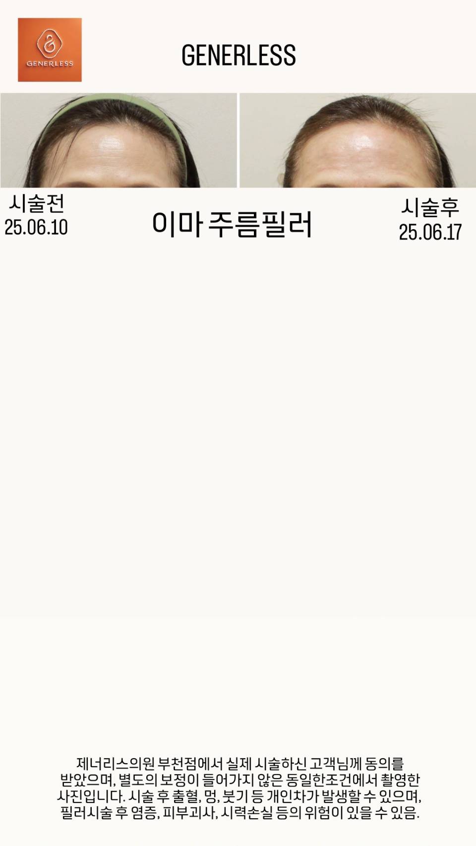 제너리스의원 부천점 대표 이미지