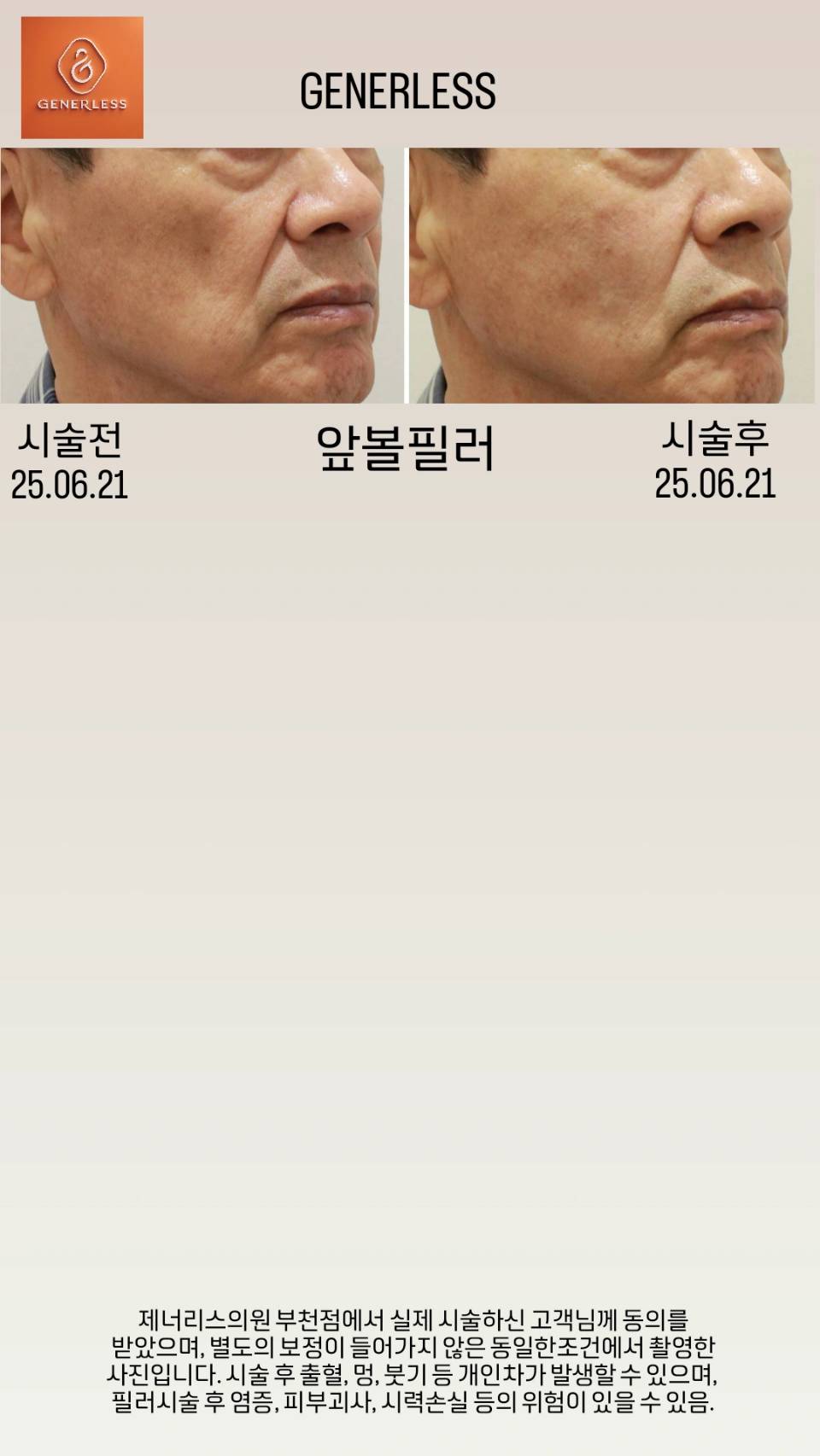 제너리스의원 부천점 대표 이미지