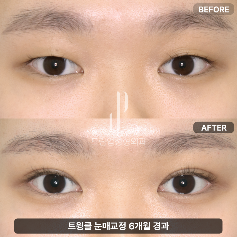 드림업성형외과의원 대표 이미지