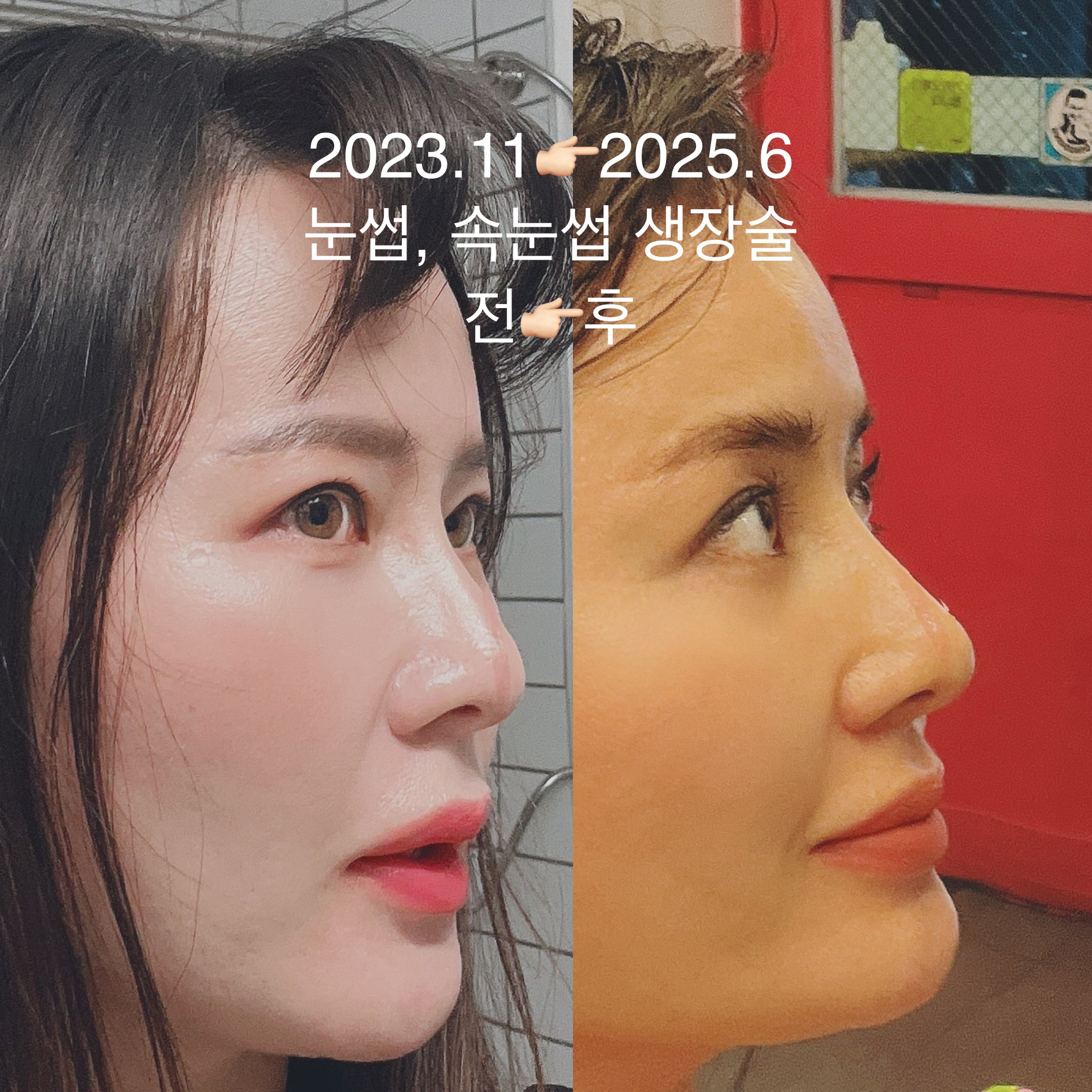 히트왁싱태닝 대표 이미지
