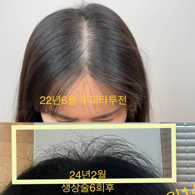 히트왁싱태닝 대표 이미지