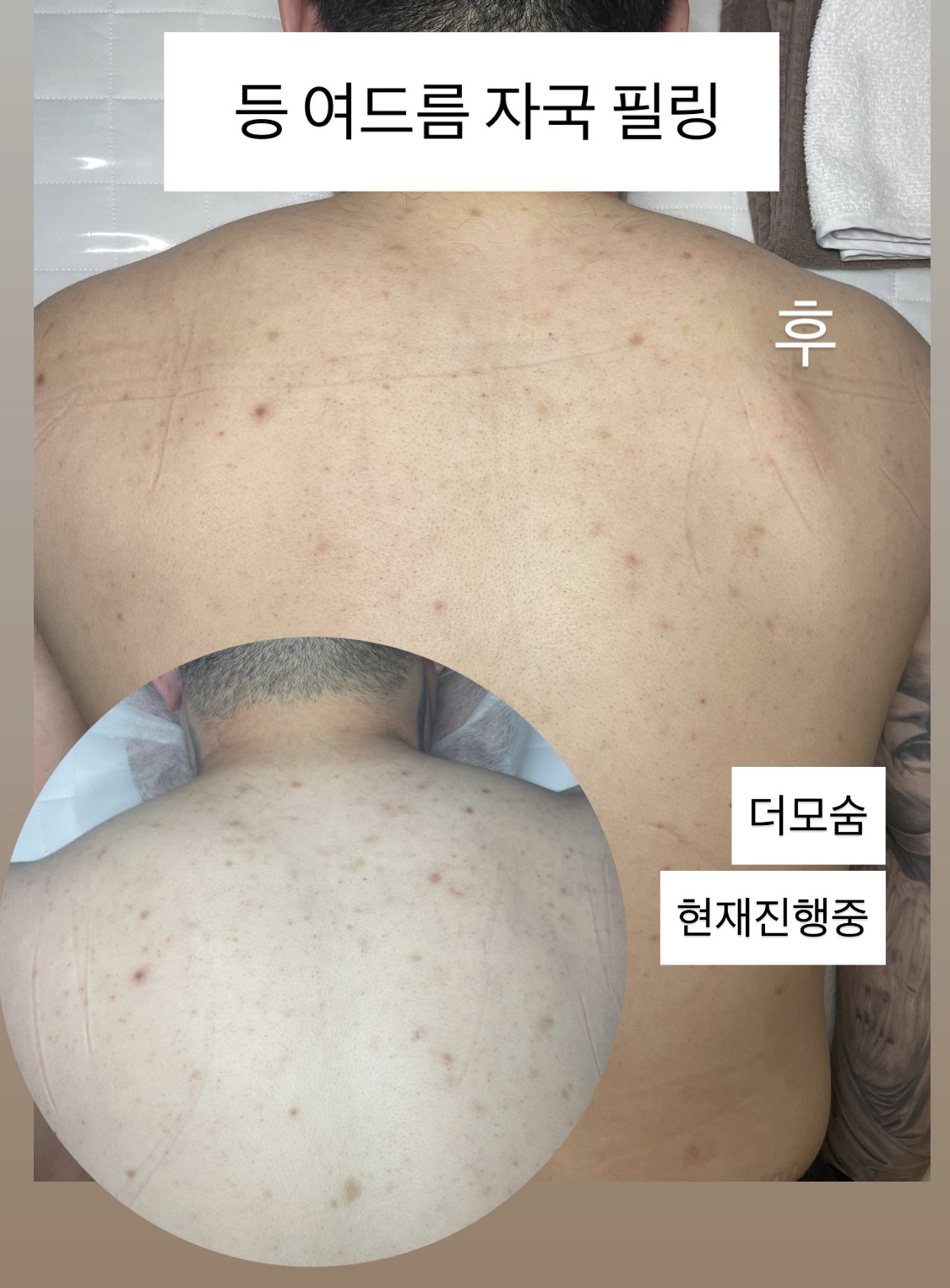 더모숨 신영통점 대표 이미지