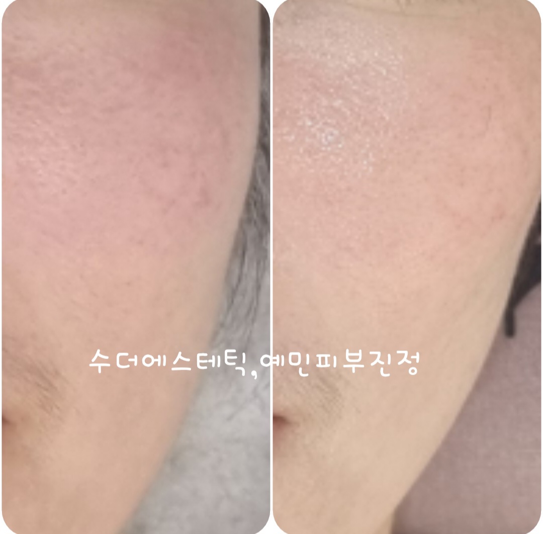 수올린에스테틱 대표 이미지