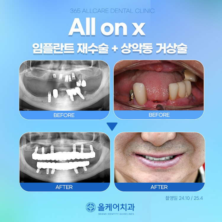 365올케어치과의원 대표 이미지