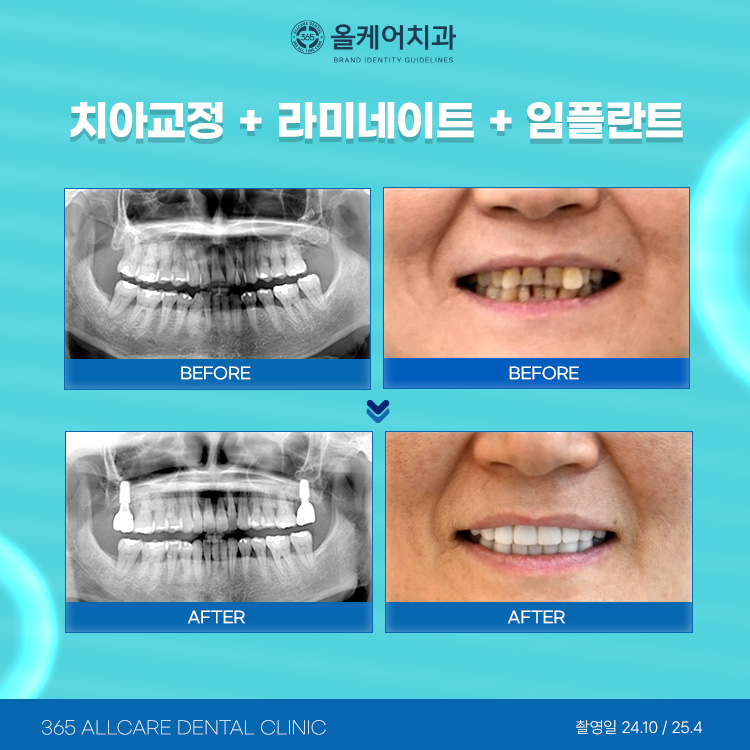 365올케어치과 대표 이미지