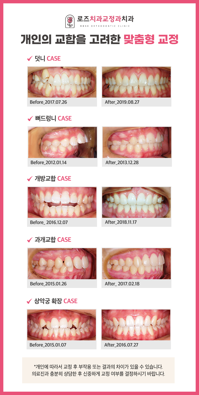로즈치과교정과치과의원 대표 이미지
