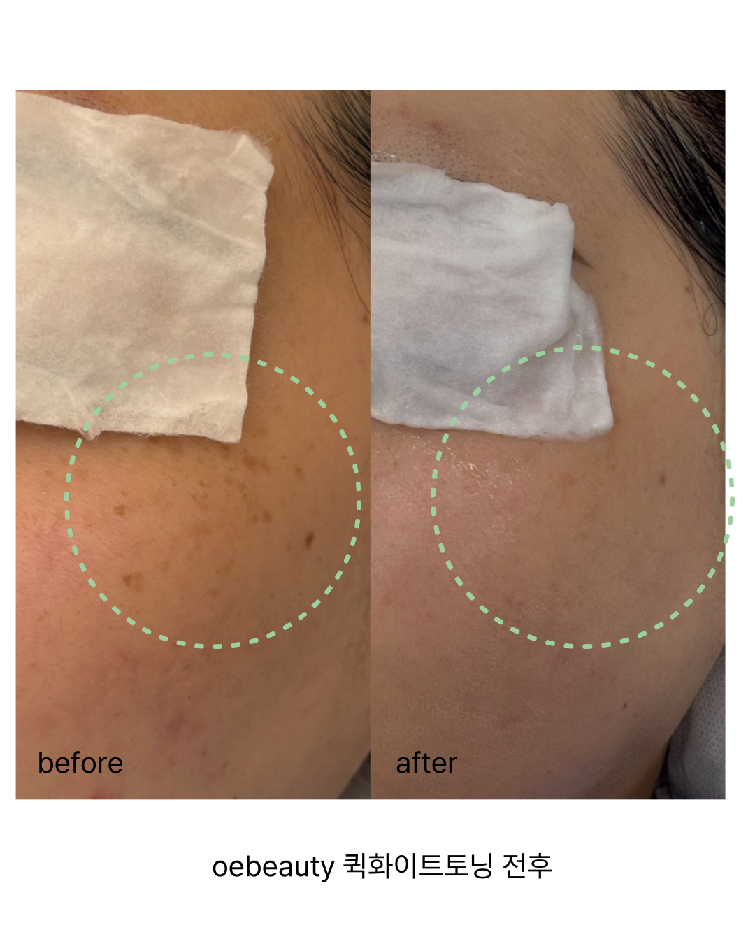 오이뷰티 대표 이미지