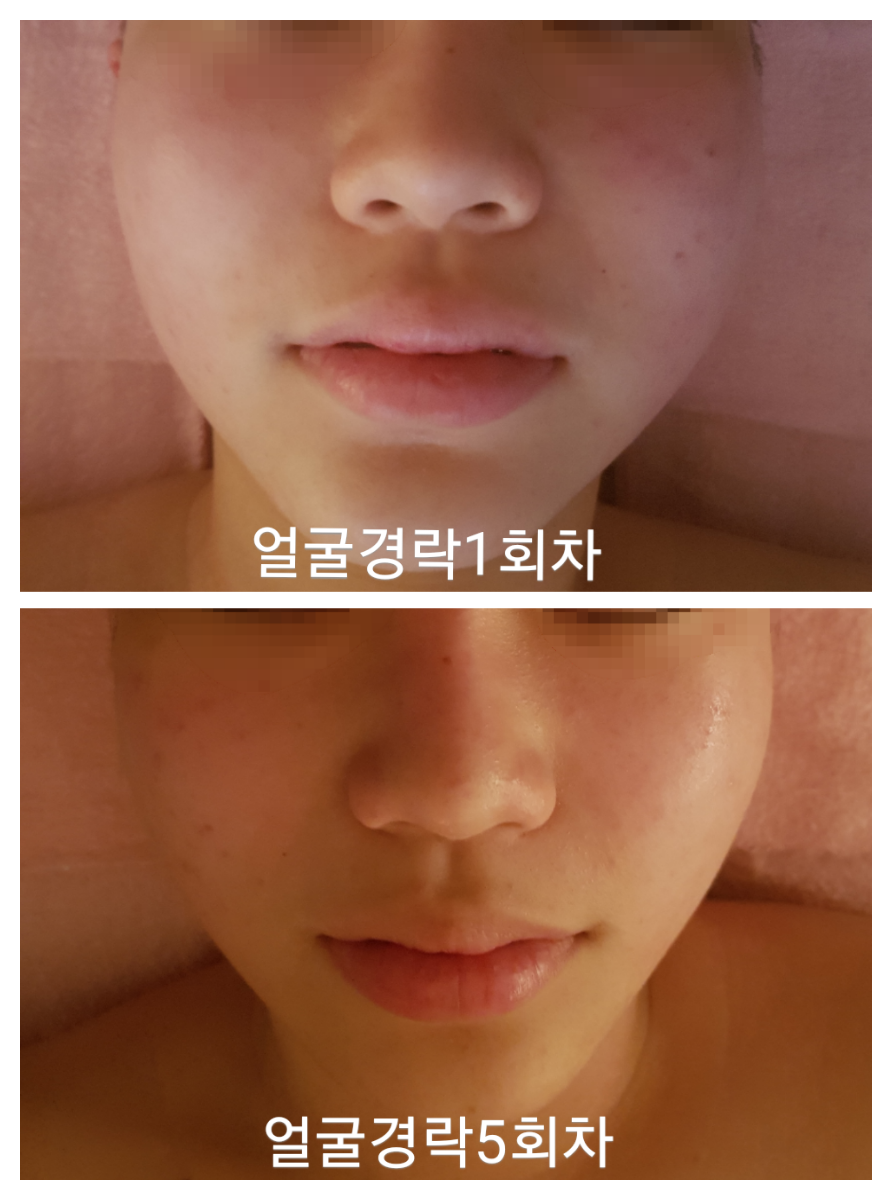예쁜얼굴 대표 이미지